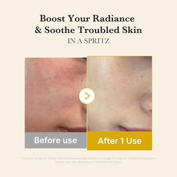 Medicube Turmeric Vitamin Gold Jelly Mist Serum, 2-in-1 Daily Facial Spray & Serum with Vitamin C, Turmeric & Panthenol, Hydrating & Calming Care, Lightweight Korean Skincare