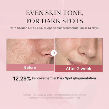 medicube PDRN Pink Collagen Serum + PDRN CICA Soothing Toner Set, Korean Skincare Duo with Salmon DNA, Exosome & Peptides for Uneven Skin Tone, Pore Care and Skin Texture