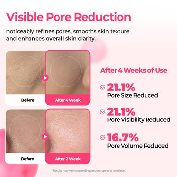 Dr.Melaxin Pink Spicule Cyano Niacinamide Serum – Vitamin B12 Pore Minimizer, Liquid Microneedle Facial Treatment for Enlarged Pores, Microneedling Skin Renewal & Texture Refining (30ml)