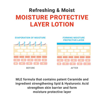 ATOPALM | MLE Lotion | Body Lotion for Extremely Dry Skin | Long-Lasting Hydration with Ceramide | Baby Moisturizer | Skin Barrier & Redness Relief | Body Cream for Sensitive Skin | 4.05 fl oz (120ml)