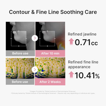 medicube PDRN Pink Tension Up Sheet Mask - 3-Step Contouring Mask | Full-Face Firming Care with Salmon PDRN, NAD & Caffeine - Korean Skincare, 34g x 4ea, Tightening Band