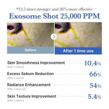 medicube Exosome Shot Zero 25,000 PPM Spicule Facial Serum | Liquid Skin Booster Serum | Exosome, AHA+BHA+PHA | Pore Care, Dead Skin Cells, Skin Texture | Korean Skincare, 0.43 fl.oz