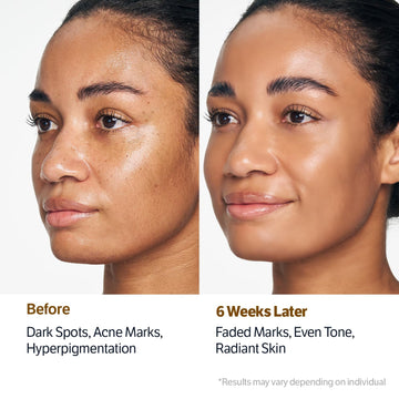 SUNGBOON EDITOR Kojic Acid Niacinamide Radiance Soothing Gel Cleanser (Original 4.23oz)