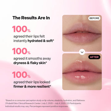 Torriden CELLMAZING Glass-Like Shine Lip Essence (PACK OF 2) , 11ml (0.37 fl.oz) Weightless Hydration for Smooth, Glossy Lips | 5D Collagen, Peptide, Jojoba Oil | Non-Sticky Korean Lip Care