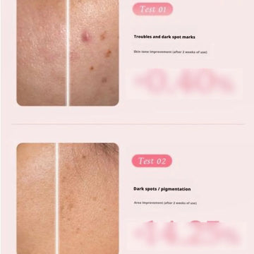Medicube PDRN Pink Hyaluronic Moisturizing Cream 50ml