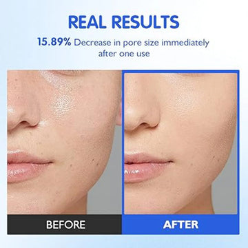 Zero Pore Pads 2.0 (2025 New) – Dual-Textured Facial Toner Pads for Gentle Exfoliation