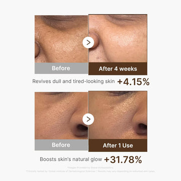 Medicube Deep Vitamin C Capsule Serum | Hydrating Facial Serum for Dull & Uneven Looking Skin | Liposome Vitamin Capsules for Radiant & Smooth Skin Texture | Korean Skincare, 1.01 fl oz