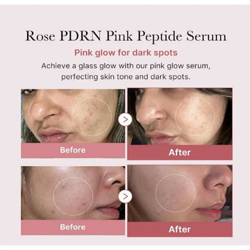 Medicube - PDRN Pink Peptide Serum (30ml)